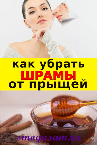 smogusam shramy